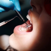 Wat doet een mondhygienist - Kiesz
