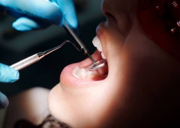 Wat doet een mondhygienist - Kiesz